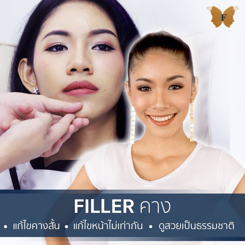 คุณเบียร์  รองอันดับ 1 มิสแกรนด์สมุทรสาคร2018